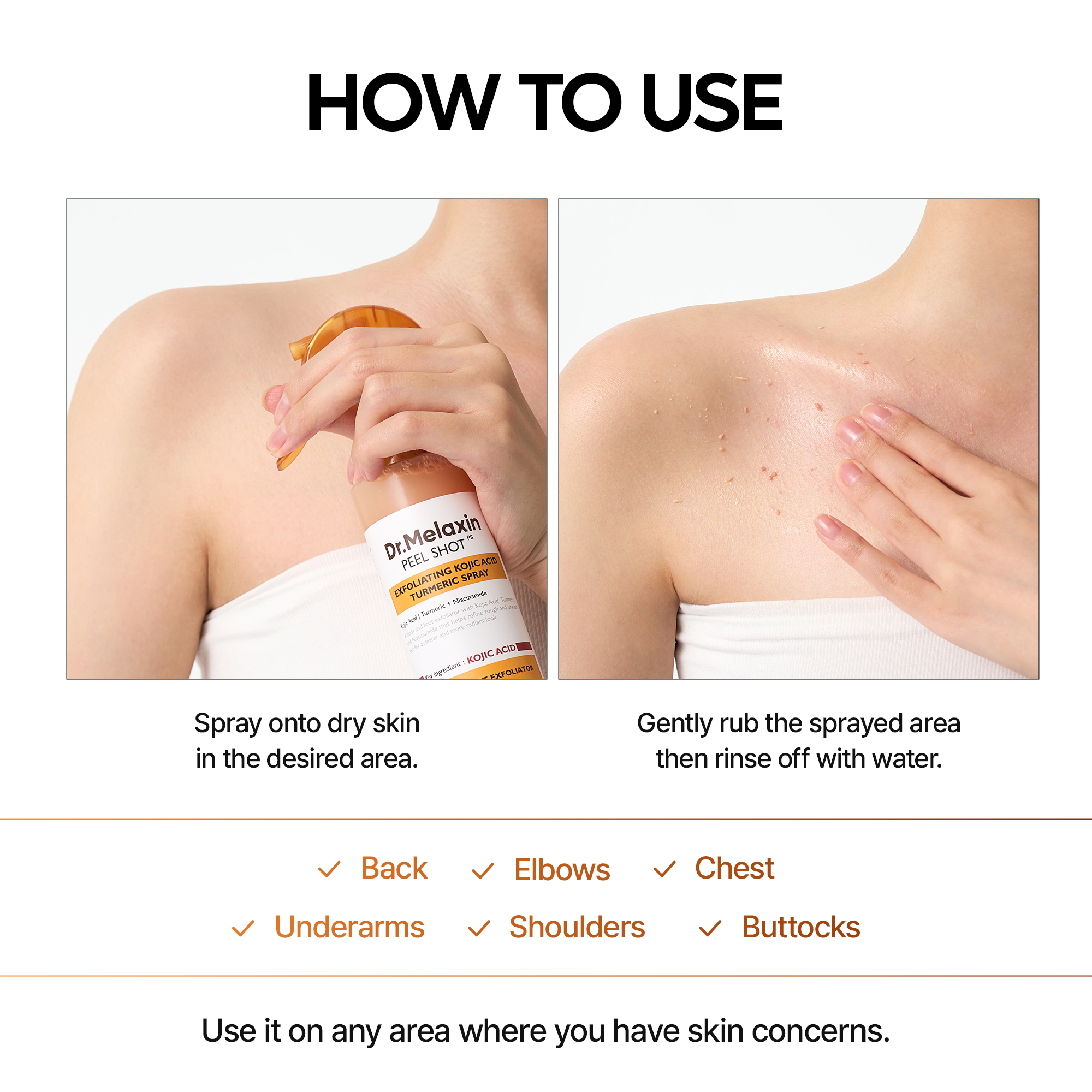 Peel Shot Kojic Acid Turmeric Spray